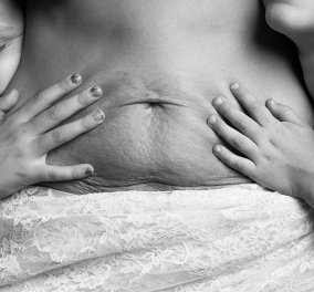 Δεν είμαστε πάντα άψογες μετά τη γέννα: Ρεαλιστικές εικόνες για τη ''μεταμόρφωση'' της κοιλιάς μιας γυναίκας μετά τον τοκετό! (Slideshow)