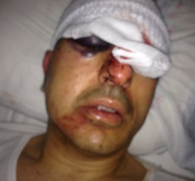 Σοκάρουν οι φωτογραφίες από τη δολοφονική επίθεση κατά του αντιδημάρχου Ηρακλείου - Έπεσε θύμα εκβιασμού από αγνώστους