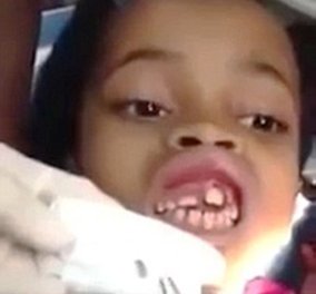 Απίστευτο story: 10χρονο κοριτσάκι ''φιλοξενούσε'' μέσα στα ούλα της όχι 1, όχι 2 αλλά... 15 σκουλήκια! (Φωτό - βίντεο) 