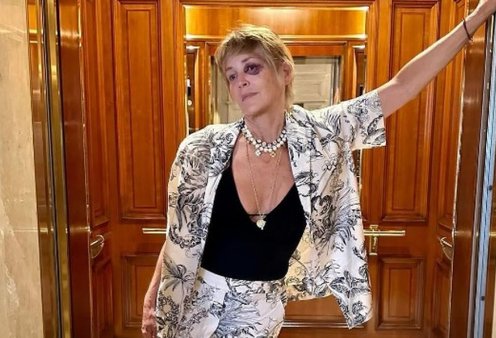 Sharon Stone: Ποιος σε πείραξε; Η αινιγματική φωτό με μαυρισμένο μάτι στο ασανσέρ 